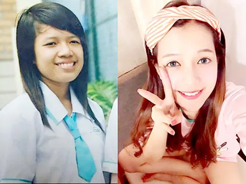 Thỏa ước mơ nhờ phẫu thuật thẩm mỹ