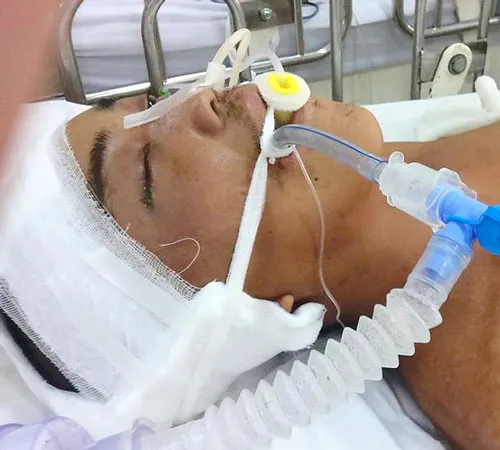 Đại họa ập đến