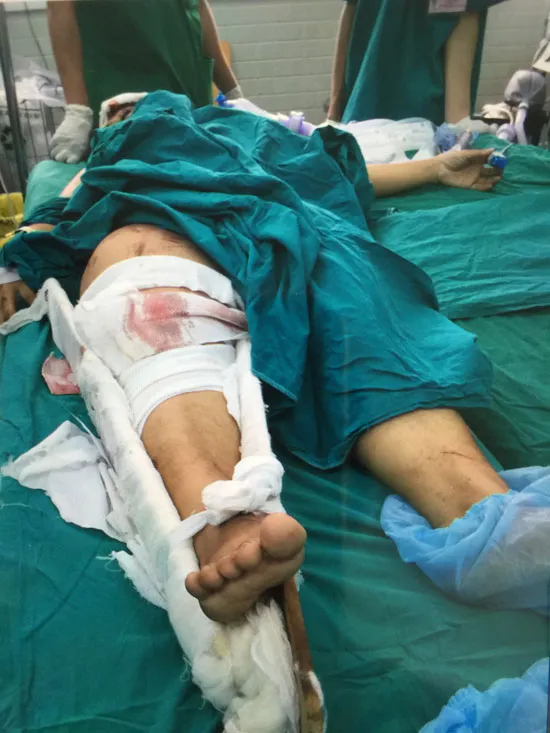 Vụ xe tải đâm vào nhà dân: Nạn nhân sống sót đang được phẫu thuật cấp cứu