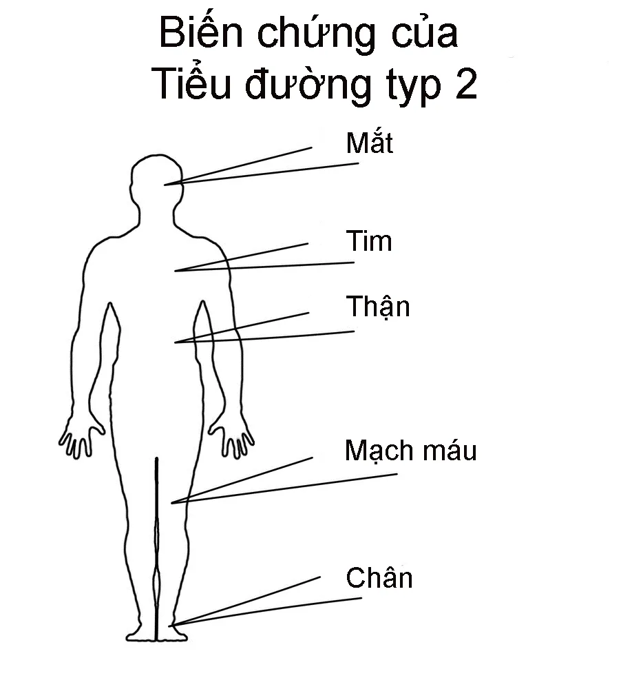 Bệnh nào dễ một thành hai?