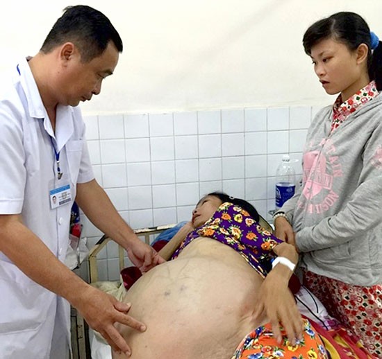 A doctor examines the woman's condition before the operation (Photo; SGGP)