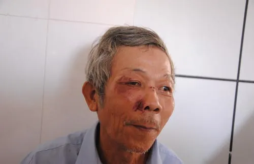 TP Huế: Cán bộ UBND phường đánh dân rồi phóng xe về trụ sở?