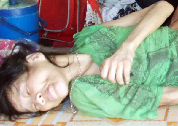 Anh khuyết tật nuôi em dị tật, con bệnh tim