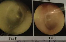 Thêm một nữ sinh bị đánh vì ra làm chứng vụ 4 nữ sinh Huế đánh bạn ngay tại trường