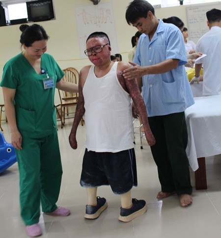 Senior lieutenant Dinh Van Duong tries to take his first steps on the artificial legs. — Photo soha.vnby Phuong Hoang and Lan Anh