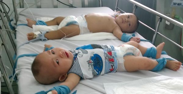 Two kids in one beds. Hospital mangers in Ho Chi Minh City promise to have enough beds for all patients (PHoto: SGGP)