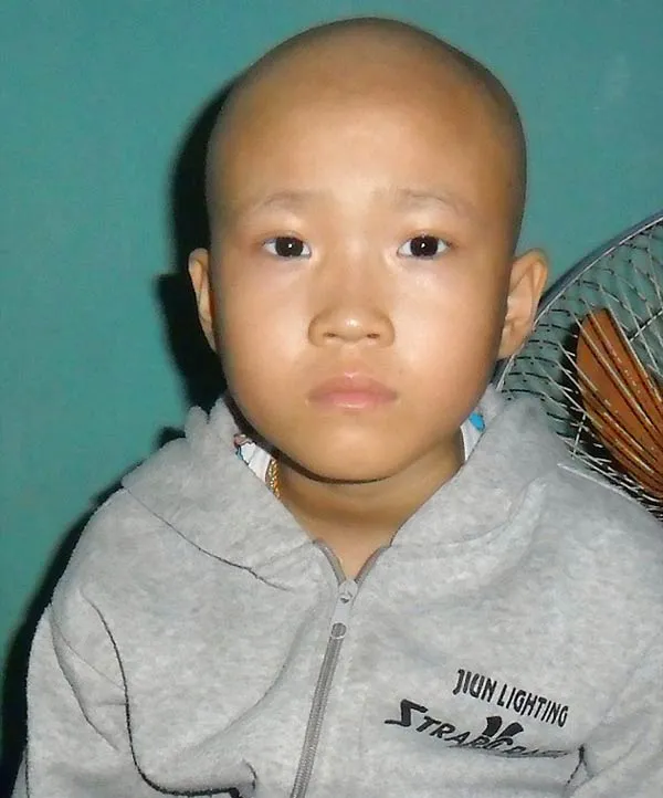 Cháu gái 11 tuổi bị ung thư ác tính