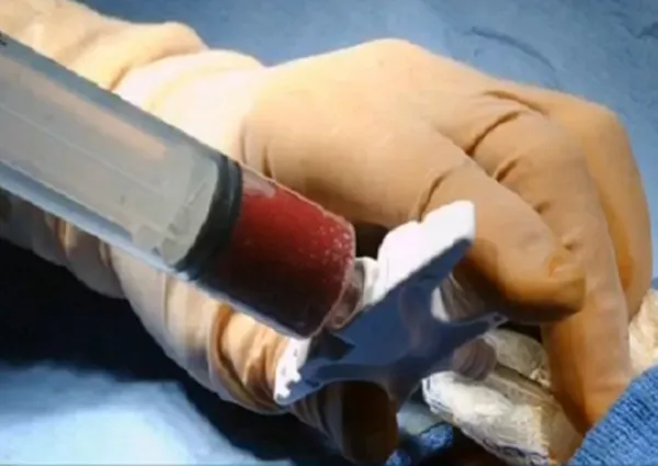 “Loạn” dược phẩm tế bào gốc chưa được cấp phép