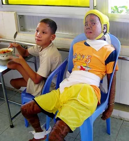 55 năm thảm họa da cam ở Việt Nam - Tận cùng của nỗi đau