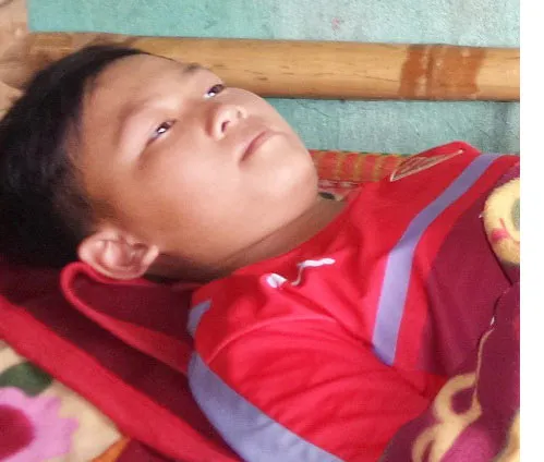 Em cũng bị ung thư xương như anh ảnh 1 Em cũng bị ung thư xương như anh ảnh 1