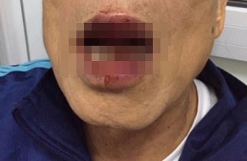 Dr. Khanh was seriously injured after the assault (Photo: SGGP)