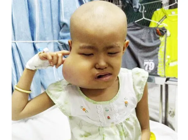 Bé gái 7 tuổi bị bướu ác hành hạ