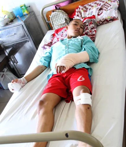 Hai thiếu niên bị chém đứt lìa tay khi đi uống cà phê