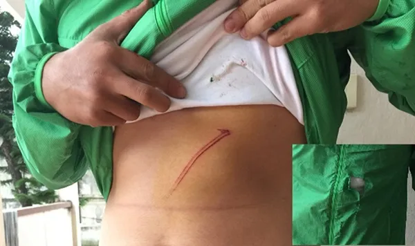 Kẻ trộm dùng hung khí chống trả làm công an bị thương