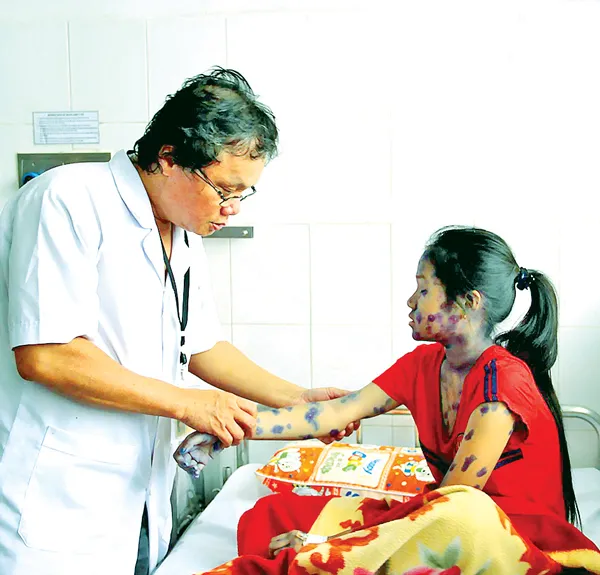 Chủ động ứng phó dịch thủy đậu