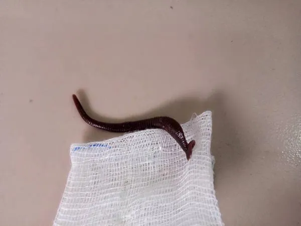 Quảng Trị: Gắp thành công con vắt rừng nằm nhiều ngày trong mũi một cháu bé