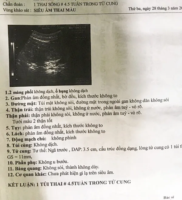 Khởi tố vụ án bé gái 10 tuổi bị cưỡng hiếp dẫn đến có thai ảnh 2