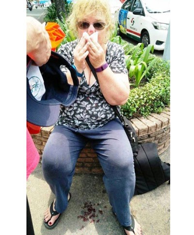 The female visitor bleeds after the incident (Photo: SGGP)