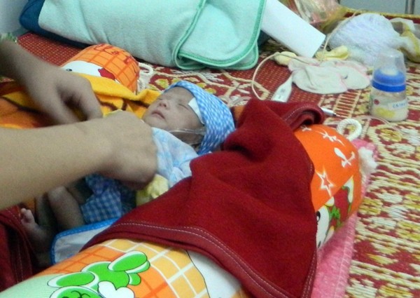 The baby after the surgery (Photo: SGGP)