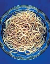 Coi chừng giun sán