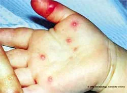 Ở mức báo động