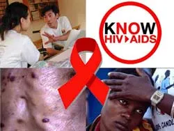 2,6 triệu Euro giảm tỉ lệ nhiễm HIV tại Việt Nam