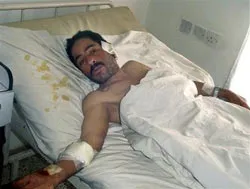 Đánh bom khủng bố, 2 người chết, 16 người bị thương