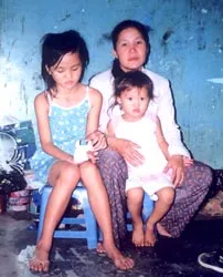 Cháu bé nghèo bị nạn