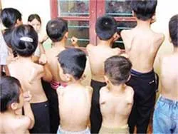 Có thể phòng ngừa