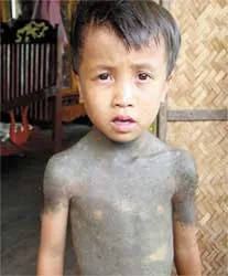 “Người rừng” ở Quảng Bình