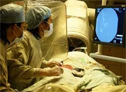 Phương pháp mới điều trị dị dạng mạch máu não