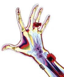 Công cụ kiểm tra an ninh siêu việt