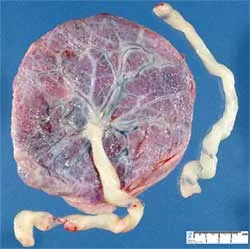 Bước tiến vĩ đại của con người