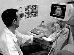 Rượu bia: Thủ phạm gây xơ gan