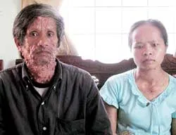 Gia đình 6 người nhiễm chất độc da cam