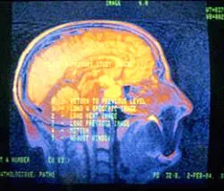 Phát hiện gien làm tăng khả năng thuận tay trái