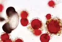 Bào tử phá vách Tasly Lingzhy.