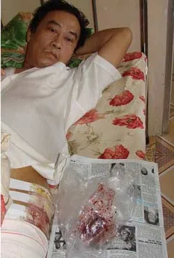 Đơn vị điều trị chưa lên tiếng chịu trách nhiệm?