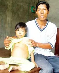 Anh Dũng với 3 đứa con bị bệnh hiểm nghèo