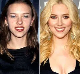 60% sao Hollywood đã phẫu thuật thẩm mỹ?