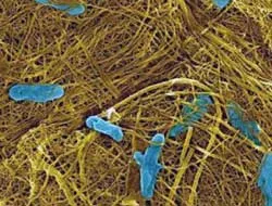 Tìm ra cách vi khuẩn biến chất thải thành điện