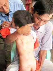 Giáo viên chủ nhiệm nói không đánh nhưng nhà trường xin lỗi