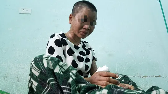 Truy tìm đối tượng hành hung người làm thuê  ảnh 3