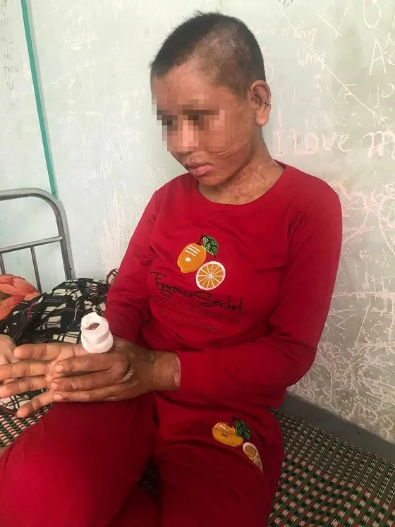 Bà chủ hành hung dã man người làm thuê bị nghiện ma túy nặng ảnh 2