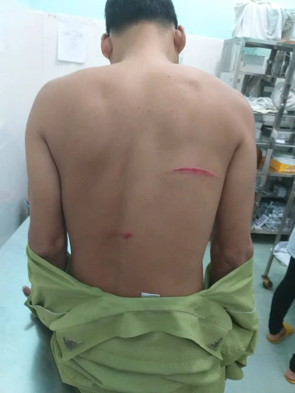 Xin lại gỗ không được, lâm tặc rượt chém kiểm lâm ảnh 2