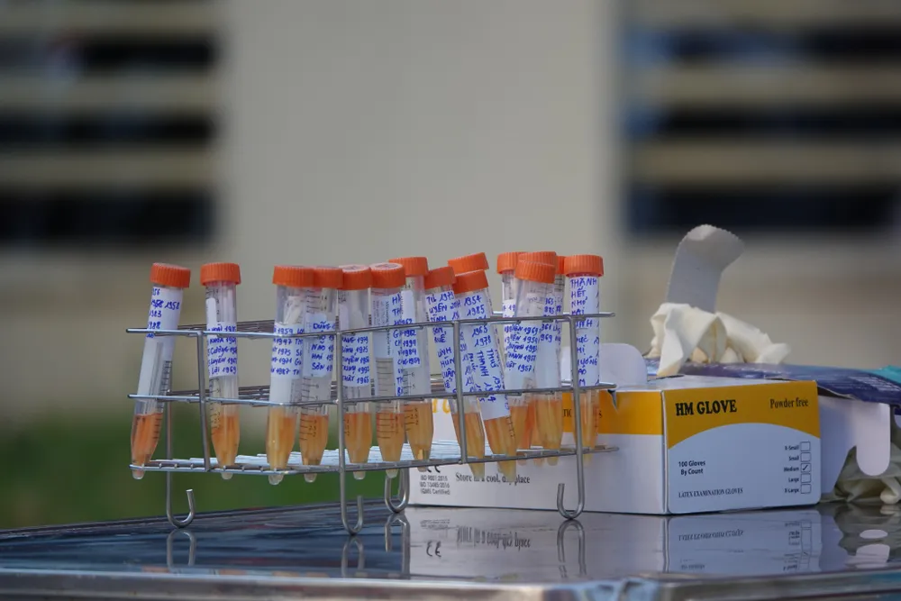 Đà Nẵng bắt đầu xét nghiệm SARS-CoV-2 đại diện hộ gia đình ảnh 10