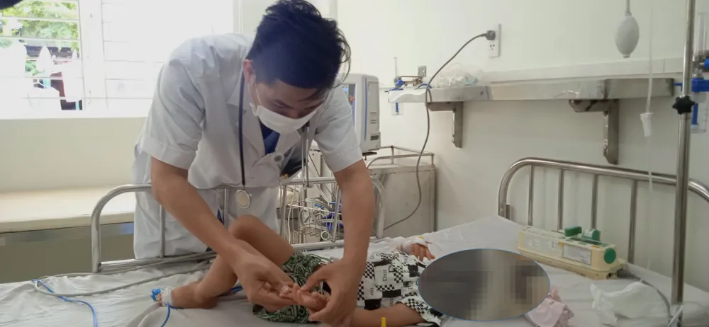 Một trường hợp mắc tay chân miệng chủng Enterovirus 71. Ảnh: XUÂN QUỲNH Một trường hợp mắc tay chân miệng chủng Enterovirus 71. Ảnh: XUÂN QUỲNH