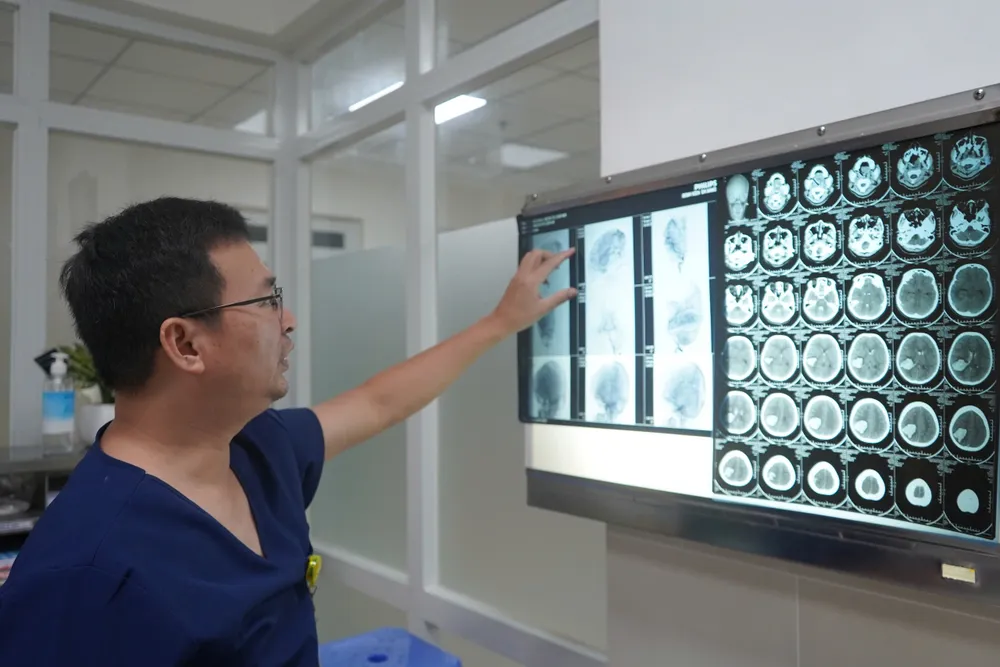 Hình ảnh dị dạng mạch máu não trước phẫu thuật..jpg