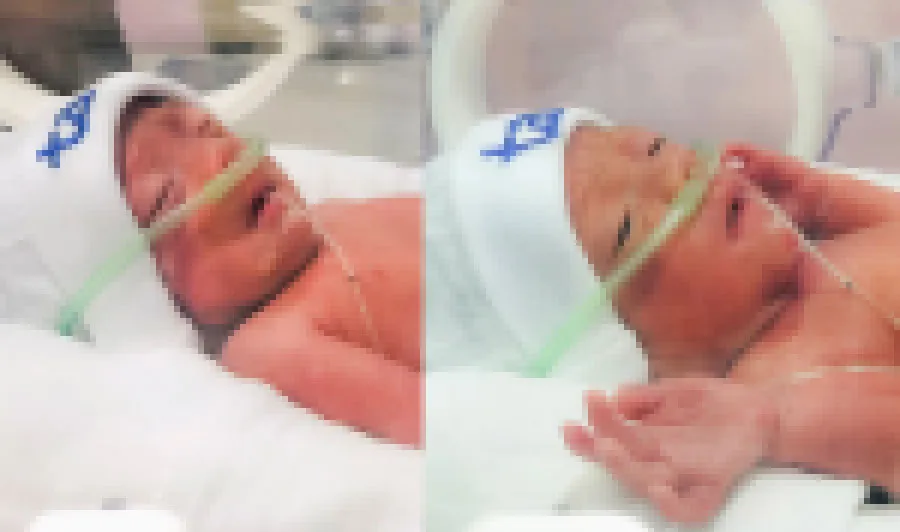 Lần đầu tiên mổ thành công ca song thai hiếm gặp ảnh 2