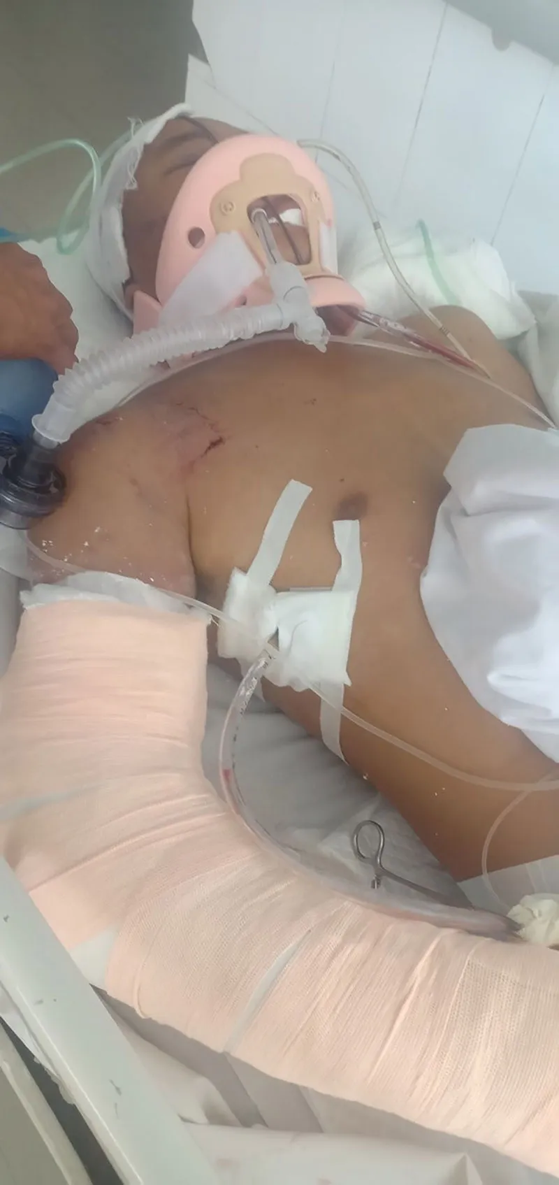 Người lao động nghèo bị tai nạn nguy kịch ảnh 1